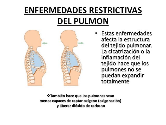 enfermedades restrictivas pulmonares